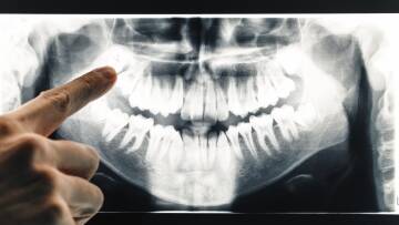 Diagnostyka radiologiczna ma istotny wpływ na przebieg leczenia - ATJ stomatologia