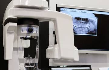rentgen zębów, Zdjęcie panoramiczne zębów, RTG zębów, pantomograf łódź, zdjęcie pantomograficzne, tomografia zębów łódź, RTG panoramiczne, panorama zębów łódź, implanty zębów łódź, Stomatologia