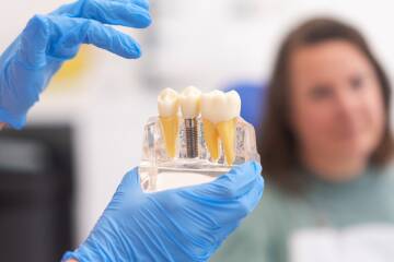 Pierwsza wizyta u chirurga stomatologicznego przed wszczepieniem implantów - ATJ Stomatologia Łódź Pierwsza wizyta u chirurga stomatologicznego przed wszczepieniem implantów - ATJ Stomatologia Łódź