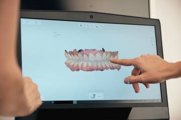 Przyszłóść technologii 3D w protetyce - ATJ Stomatologia Łódź Przyszłóść technologii 3D w protetyce - ATJ Stomatologia Łódź